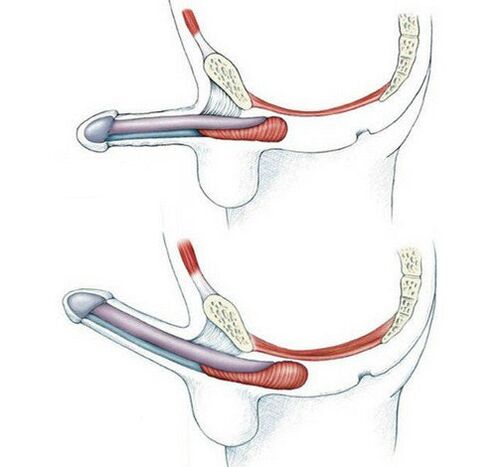 Penis without training muscle pubokocius and after