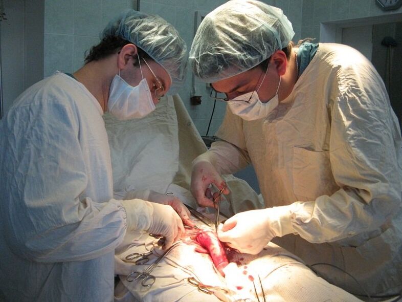 Performing a ligamentotomy - surgery to increase the length of the penis